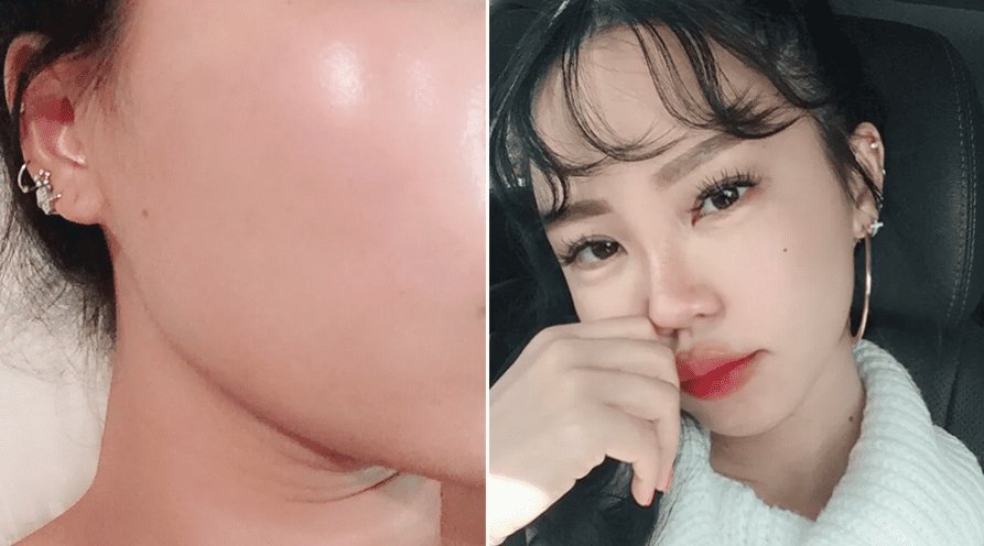 Скляна шкіра (glass skin): як досягти ефекту вдома — домашній догляд без салонів і дорогих процедур